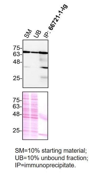 Immunoprecipitation (IP) experiment of MDA-MB-231 cells using SYK Monoclonal antibody (66721-1-Ig)