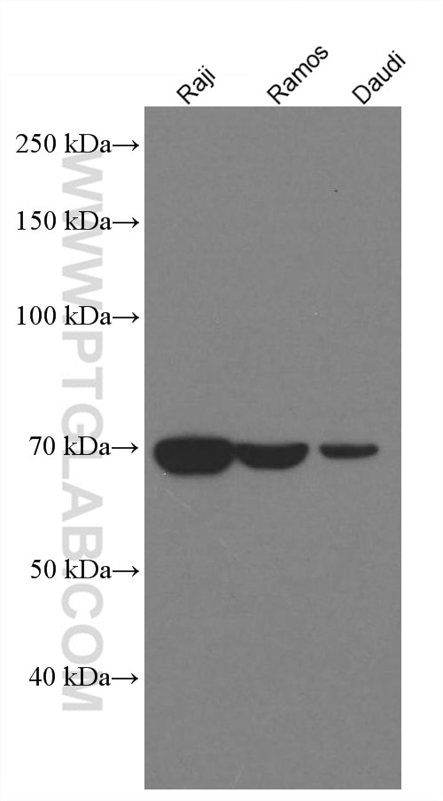 Western Blot (WB) analysis of various lysates using SYK Monoclonal antibody (66721-1-Ig)