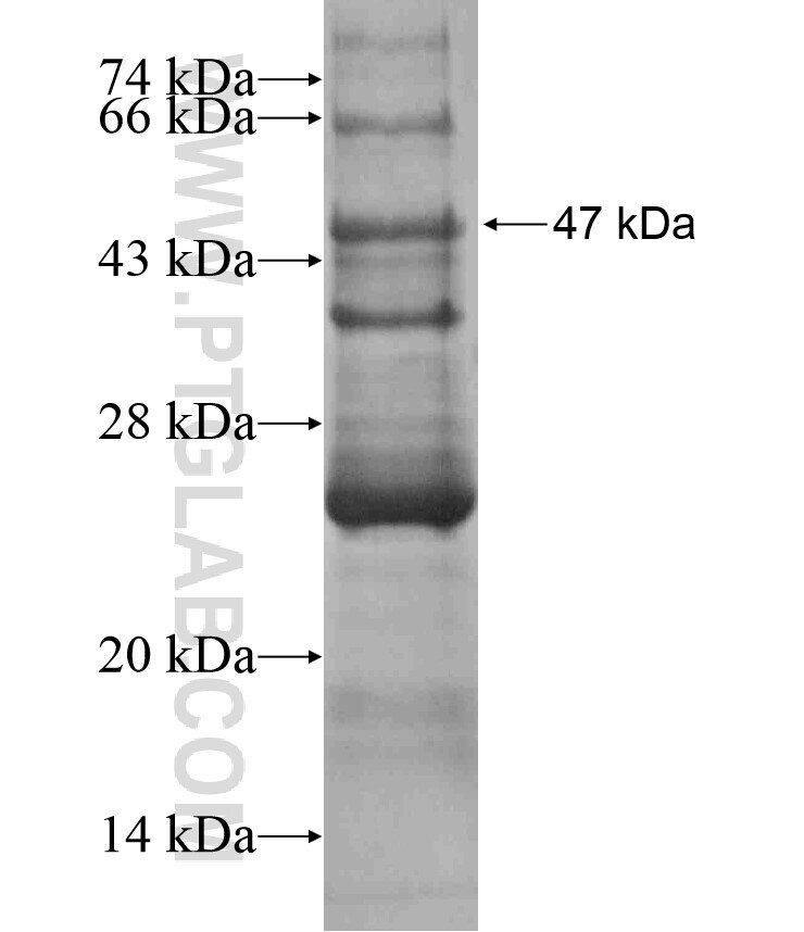 SYK fusion protein Ag17526 SDS-PAGE