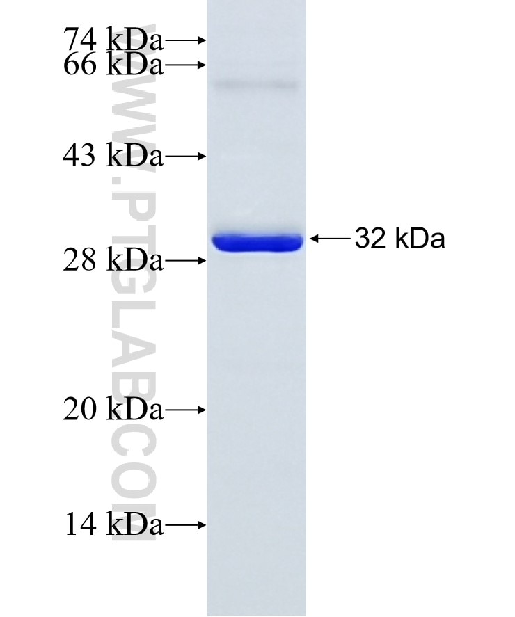 SYK fusion protein Ag17654 SDS-PAGE
