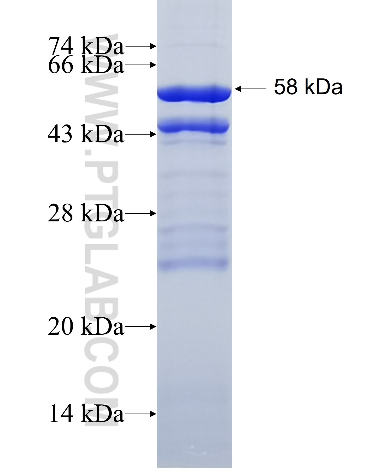 SYK fusion protein Ag6657 SDS-PAGE