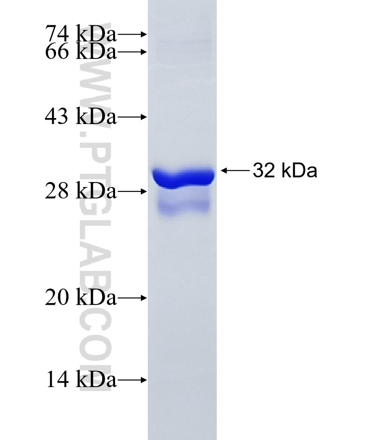 SYK fusion protein Ag6773 SDS-PAGE