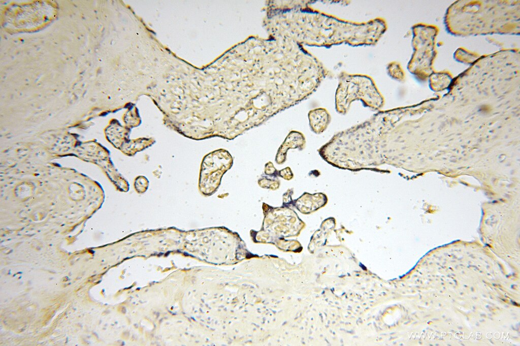 Immunohistochemistry (IHC) staining of human placenta tissue using Symplekin Polyclonal antibody (11519-1-AP)