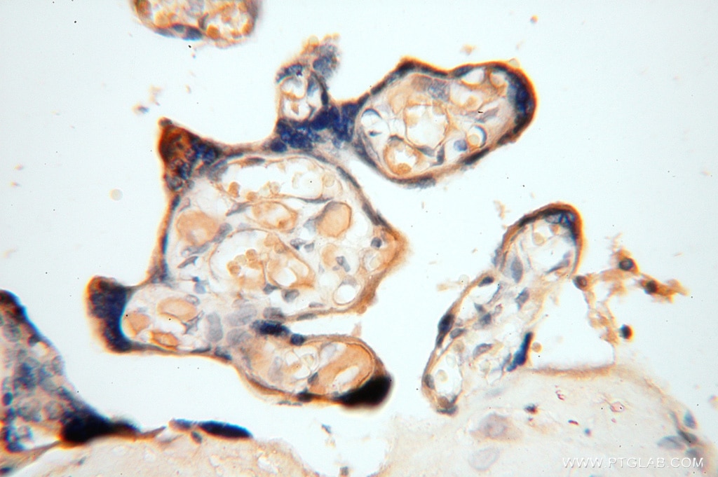 Immunohistochemistry (IHC) staining of human placenta tissue using Symplekin Polyclonal antibody (11519-1-AP)
