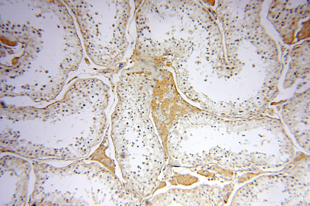 Immunohistochemistry (IHC) staining of human testis tissue using Symplekin Polyclonal antibody (11519-1-AP)