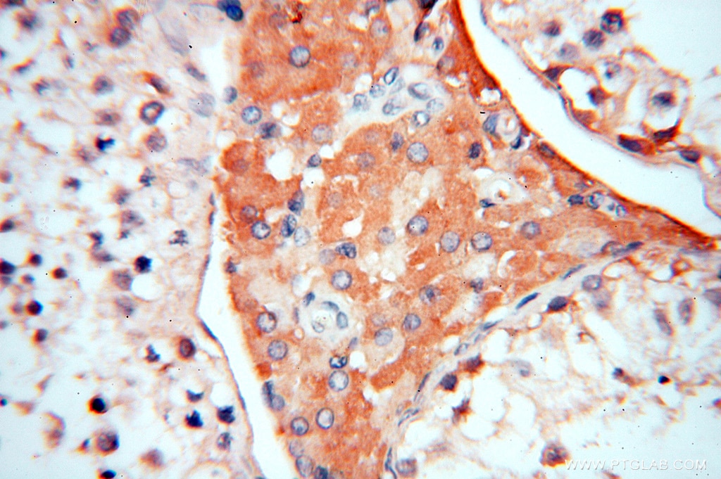 Immunohistochemistry (IHC) staining of human testis tissue using Symplekin Polyclonal antibody (11519-1-AP)