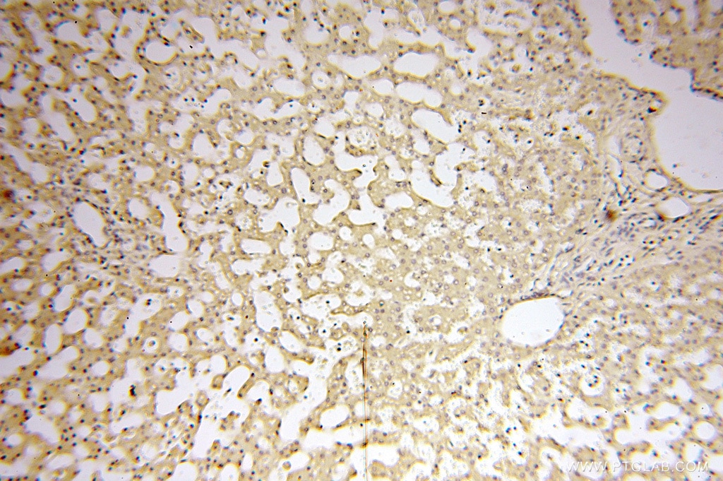 Immunohistochemistry (IHC) staining of human liver tissue using Symplekin Polyclonal antibody (11519-1-AP)