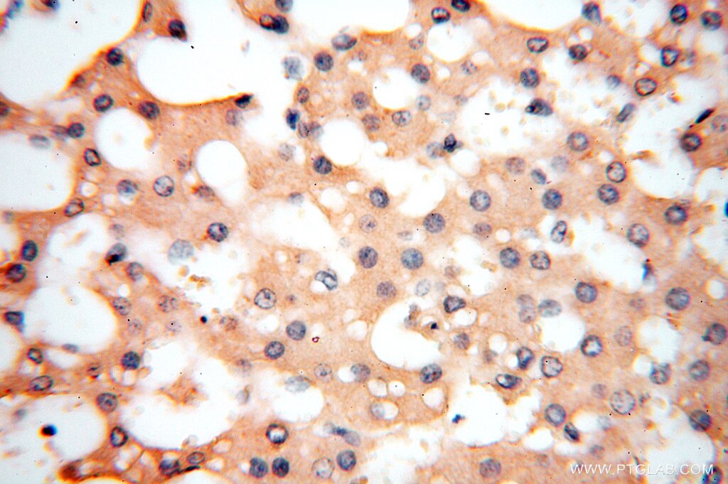 Immunohistochemistry (IHC) staining of human liver tissue using Symplekin Polyclonal antibody (11519-1-AP)
