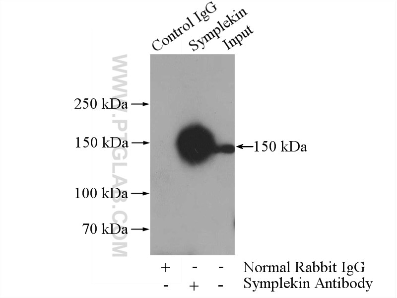 Immunoprecipitation (IP) experiment of K-562 cells using Symplekin Polyclonal antibody (11519-1-AP)