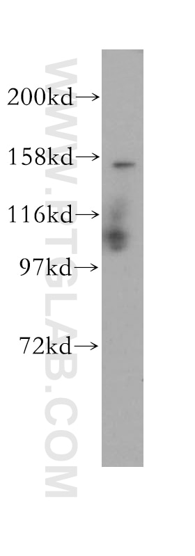 Western Blot (WB) analysis of MCF-7 cells using Symplekin Polyclonal antibody (11519-1-AP)