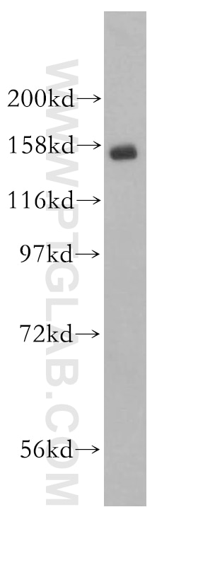 Western Blot (WB) analysis of K-562 cells using Symplekin Polyclonal antibody (11519-1-AP)