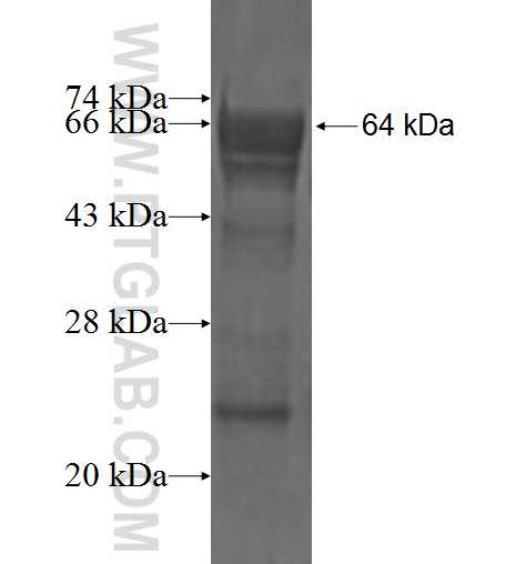 SYMPK fusion protein Ag2081 SDS-PAGE