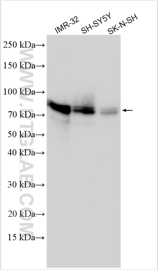 Western Blot (WB) analysis of various lysates using SYN1 Polyclonal antibody (30549-1-AP)