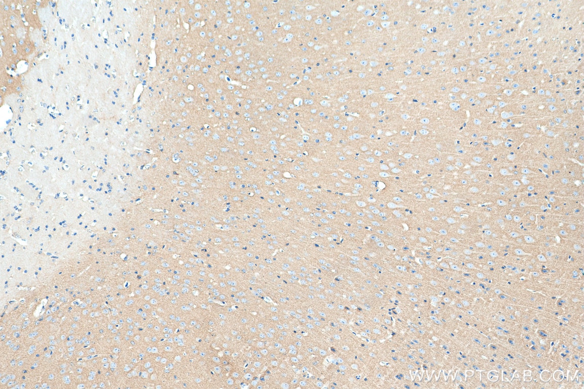 Immunohistochemistry (IHC) staining of mouse brain tissue using SYN1-Specific Polyclonal antibody (20258-1-AP)