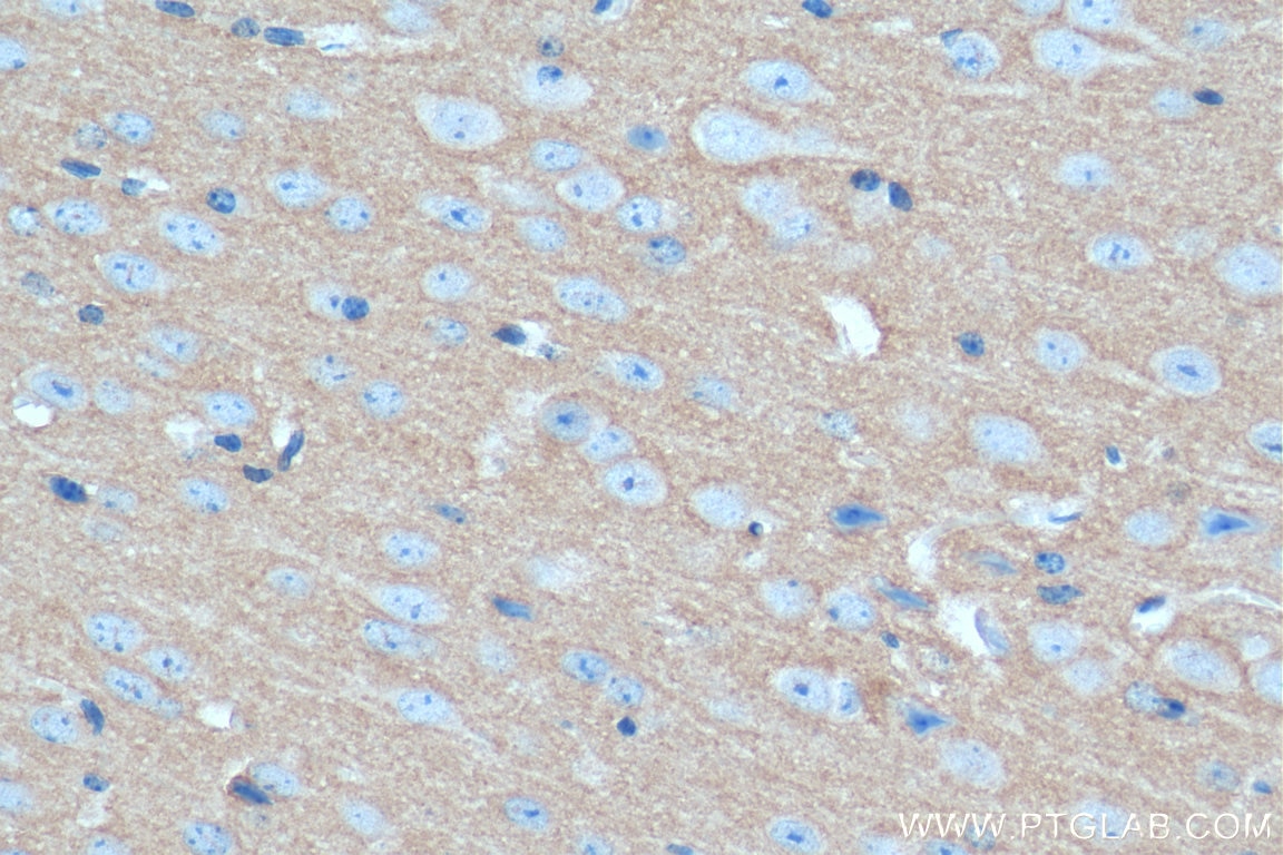Immunohistochemistry (IHC) staining of mouse brain tissue using SYN1-Specific Polyclonal antibody (20258-1-AP)
