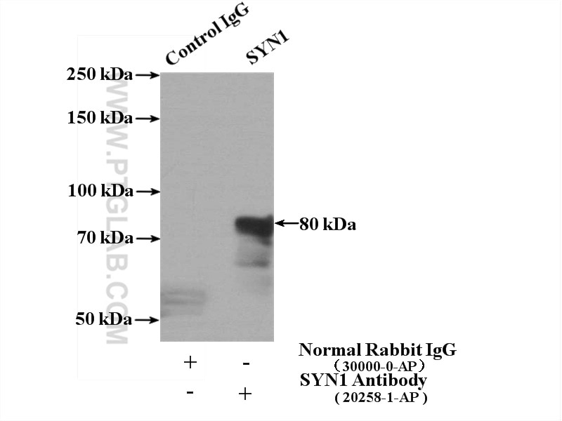 Immunoprecipitation (IP) experiment of rat brain tissue using SYN1-Specific Polyclonal antibody (20258-1-AP)