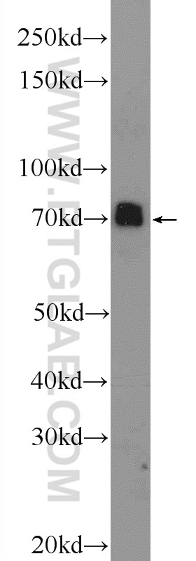 Western Blot (WB) analysis of mouse brain tissue using SYN1-Specific Polyclonal antibody (20258-1-AP)