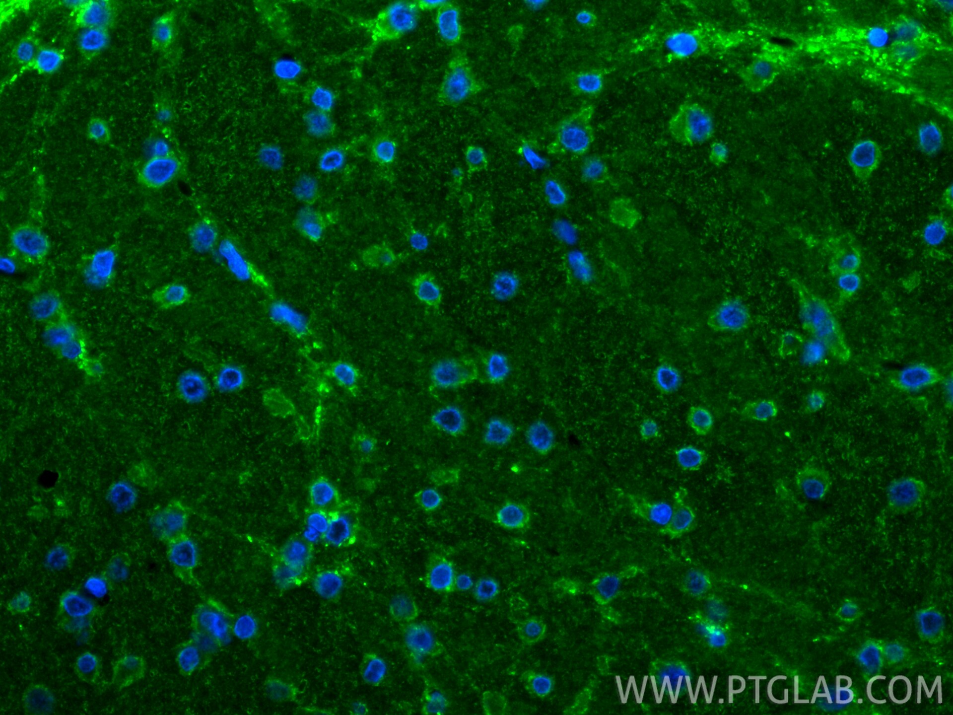Immunofluorescence (IF) / fluorescent staining of rat brain tissue using SYN1-Specific Recombinant monoclonal antibody (85360-1-RR)