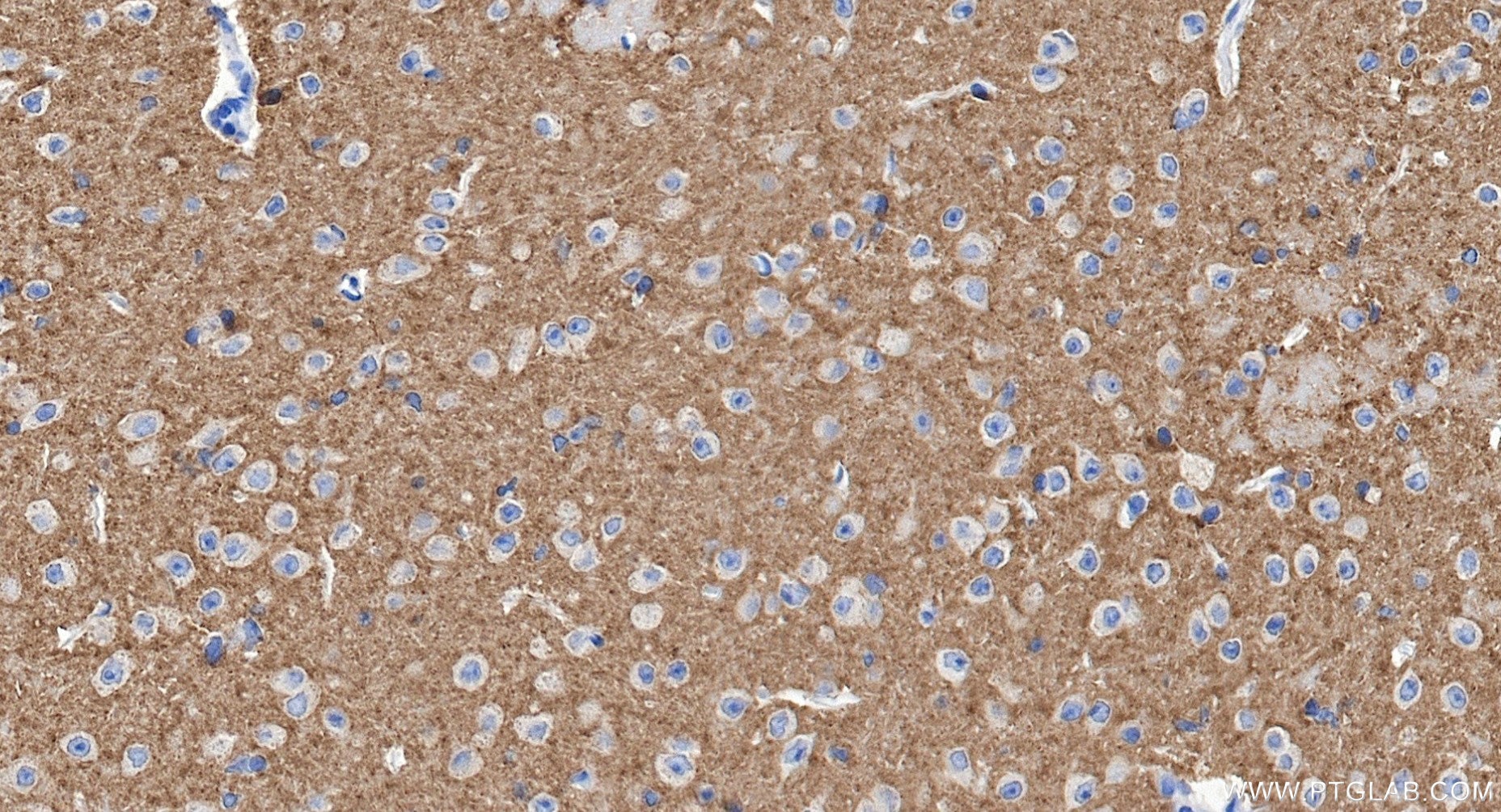 IHC staining of mouse brain using 85360-1-RR (same clone as 85360-1-PBS) Immunohistochemistry (IHC) staining of mouse brain tissue using SYN1-Specific Recombinant monoclonal antibody (85360-1-RR)