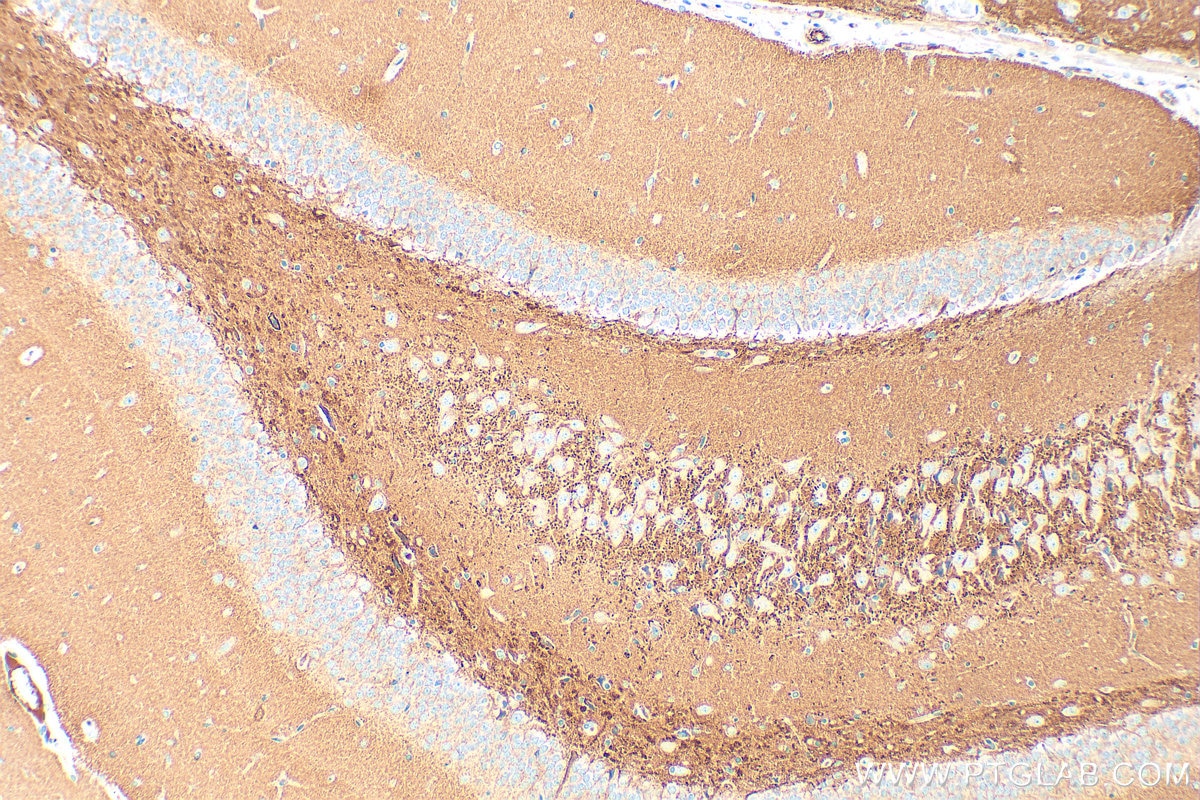 Immunohistochemistry (IHC) staining of rat brain tissue using SYN2 Polyclonal antibody (16573-1-AP)
