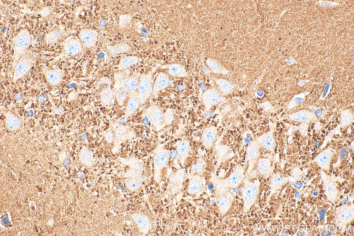 Immunohistochemistry (IHC) staining of rat brain tissue using SYN2 Polyclonal antibody (16573-1-AP)