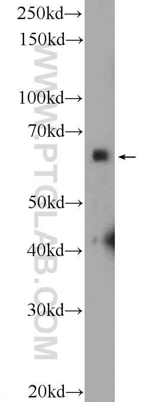 Western Blot (WB) analysis of mouse brain tissue using SYN2 Polyclonal antibody (16573-1-AP)