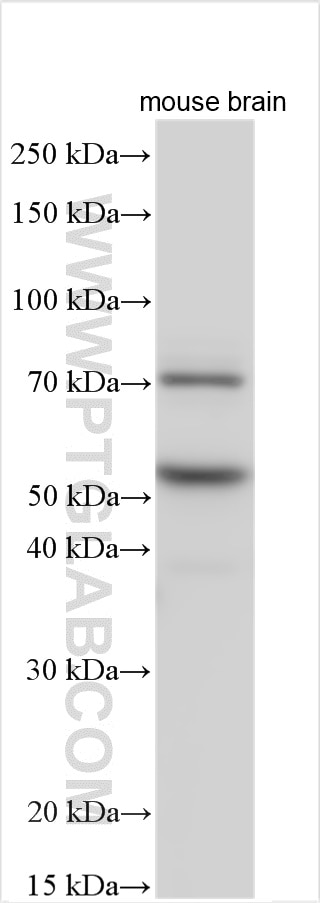 Western Blot (WB) analysis of various lysates using SYN2 Polyclonal antibody (16573-1-AP)