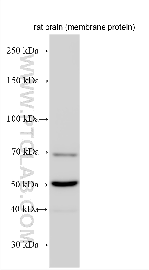 Western Blot (WB) analysis of various lysates using SYN2 Polyclonal antibody (16573-1-AP)