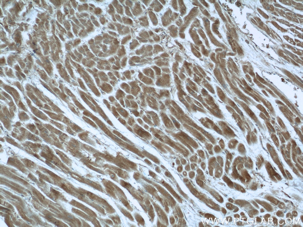 Immunohistochemistry (IHC) staining of human heart tissue using Syncoilin Polyclonal antibody (25151-1-AP)
