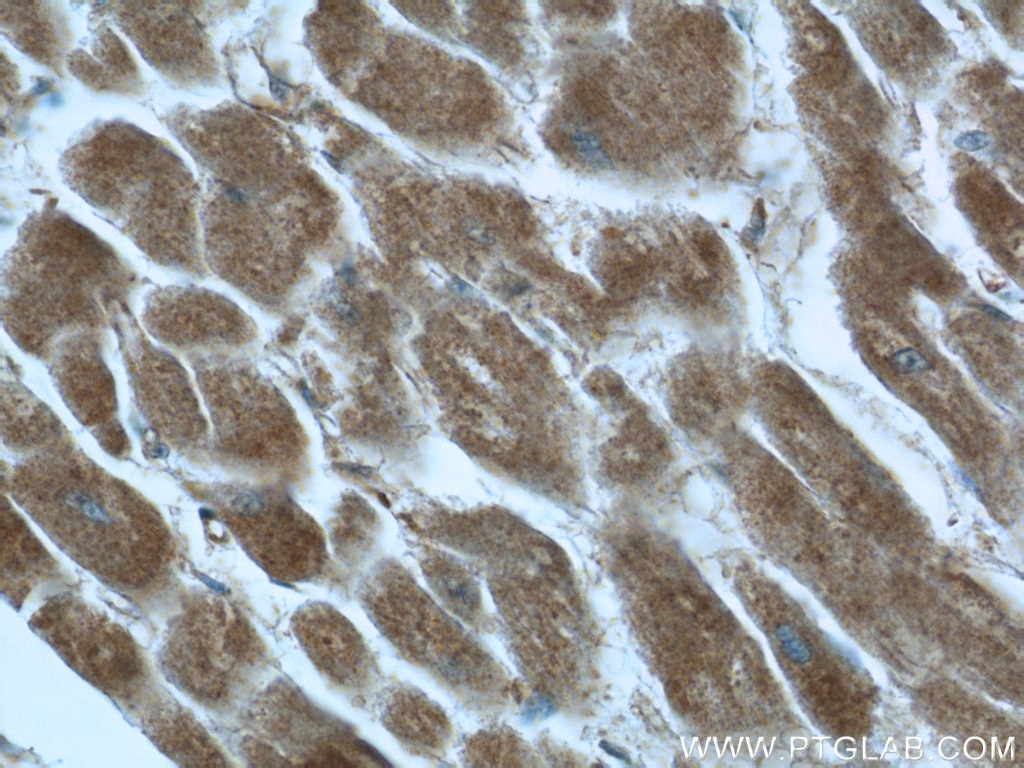 Immunohistochemistry (IHC) staining of human heart tissue using Syncoilin Polyclonal antibody (25151-1-AP)
