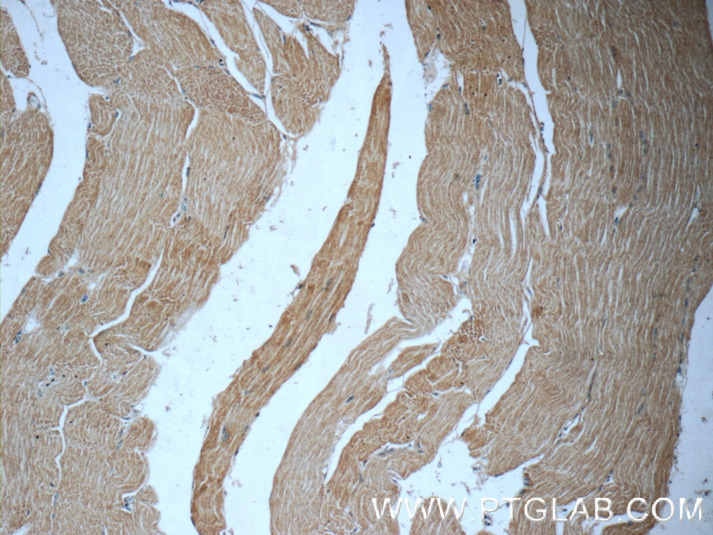 Immunohistochemistry (IHC) staining of human skeletal muscle tissue using Syncoilin Polyclonal antibody (25151-1-AP)