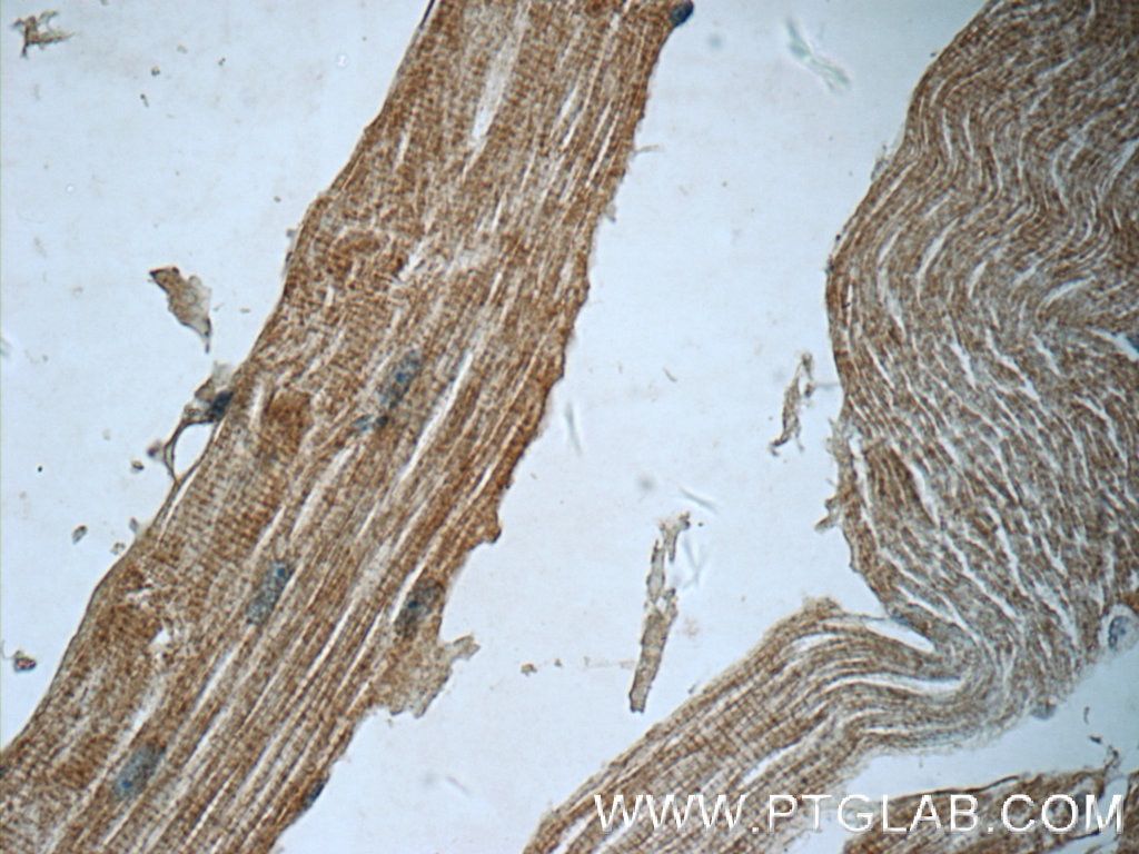 Immunohistochemistry (IHC) staining of human skeletal muscle tissue using Syncoilin Polyclonal antibody (25151-1-AP)