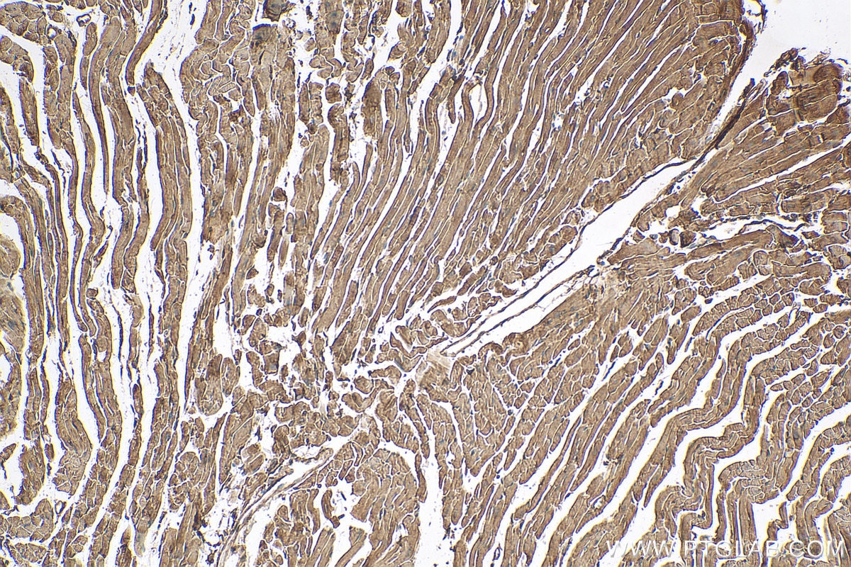 Immunohistochemistry (IHC) staining of mouse heart tissue using Syncoilin Polyclonal antibody (25151-1-AP)