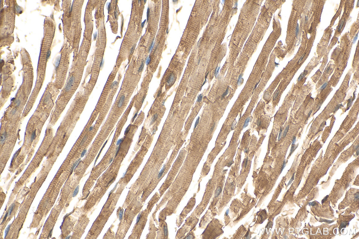 Immunohistochemistry (IHC) staining of mouse heart tissue using Syncoilin Polyclonal antibody (25151-1-AP)