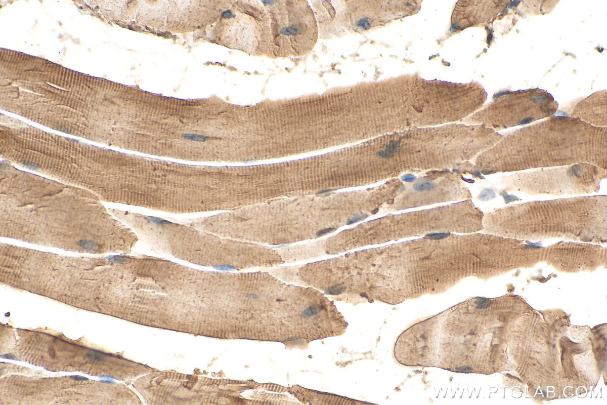 Immunohistochemistry (IHC) staining of mouse skeletal muscle tissue using Syncoilin Polyclonal antibody (25151-1-AP)