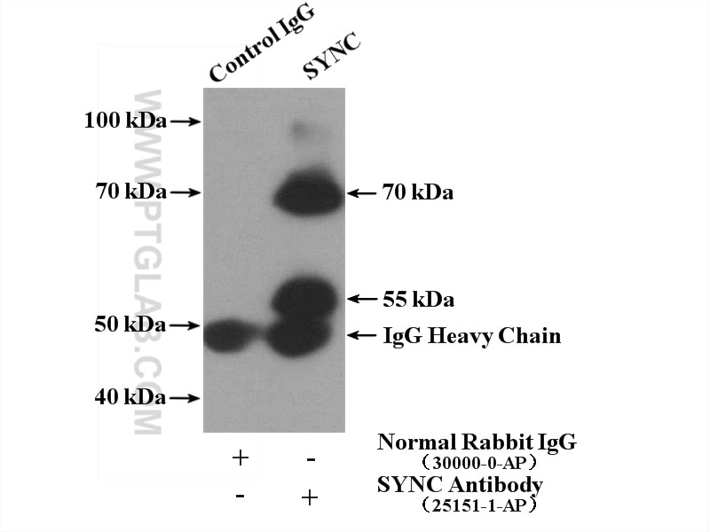 Immunoprecipitation (IP) experiment of mouse heart tissue using Syncoilin Polyclonal antibody (25151-1-AP)
