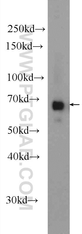 Syncoilin