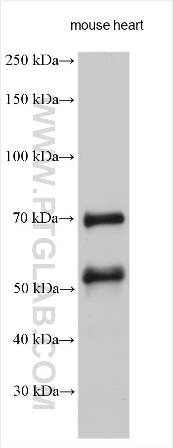 Western Blot (WB) analysis of various lysates using Syncoilin Polyclonal antibody (25151-1-AP)