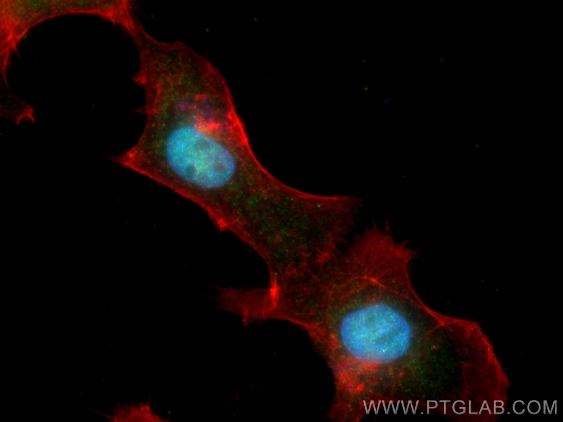 Immunofluorescence (IF) / fluorescent staining of A431 cells using SYNCRIP Polyclonal antibody (14024-1-AP)