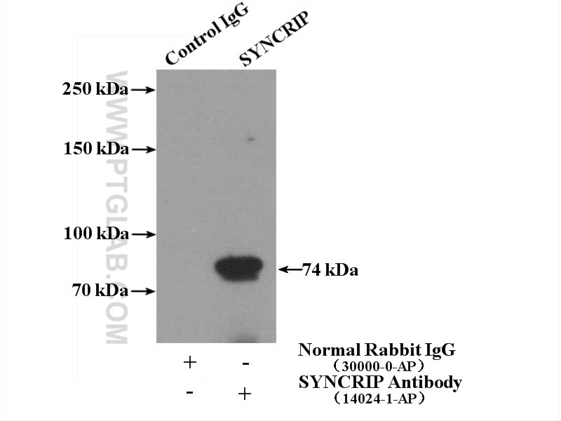 Immunoprecipitation (IP) experiment of A431 cells using SYNCRIP Polyclonal antibody (14024-1-AP)