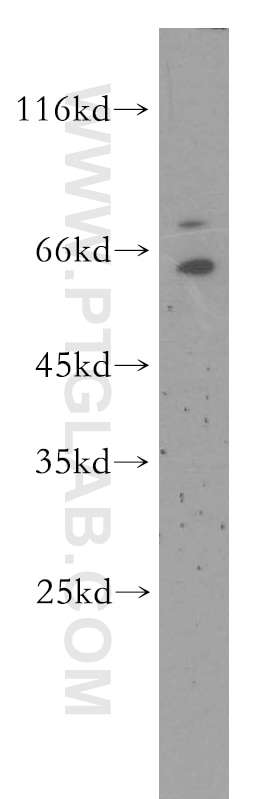 Western Blot (WB) analysis of Jurkat cells using SYNCRIP Polyclonal antibody (14024-1-AP)