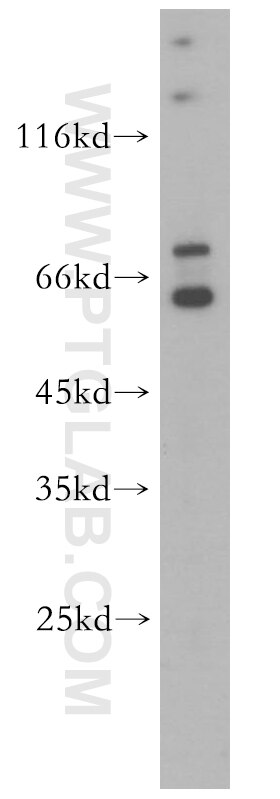 Western Blot (WB) analysis of A431 cells using SYNCRIP Polyclonal antibody (14024-1-AP)