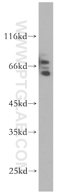 Western Blot (WB) analysis of A431 cells using SYNCRIP Polyclonal antibody (14024-1-AP)