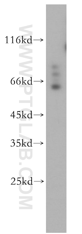 Western Blot (WB) analysis of HEK-293 cells using SYNCRIP Polyclonal antibody (14024-1-AP)