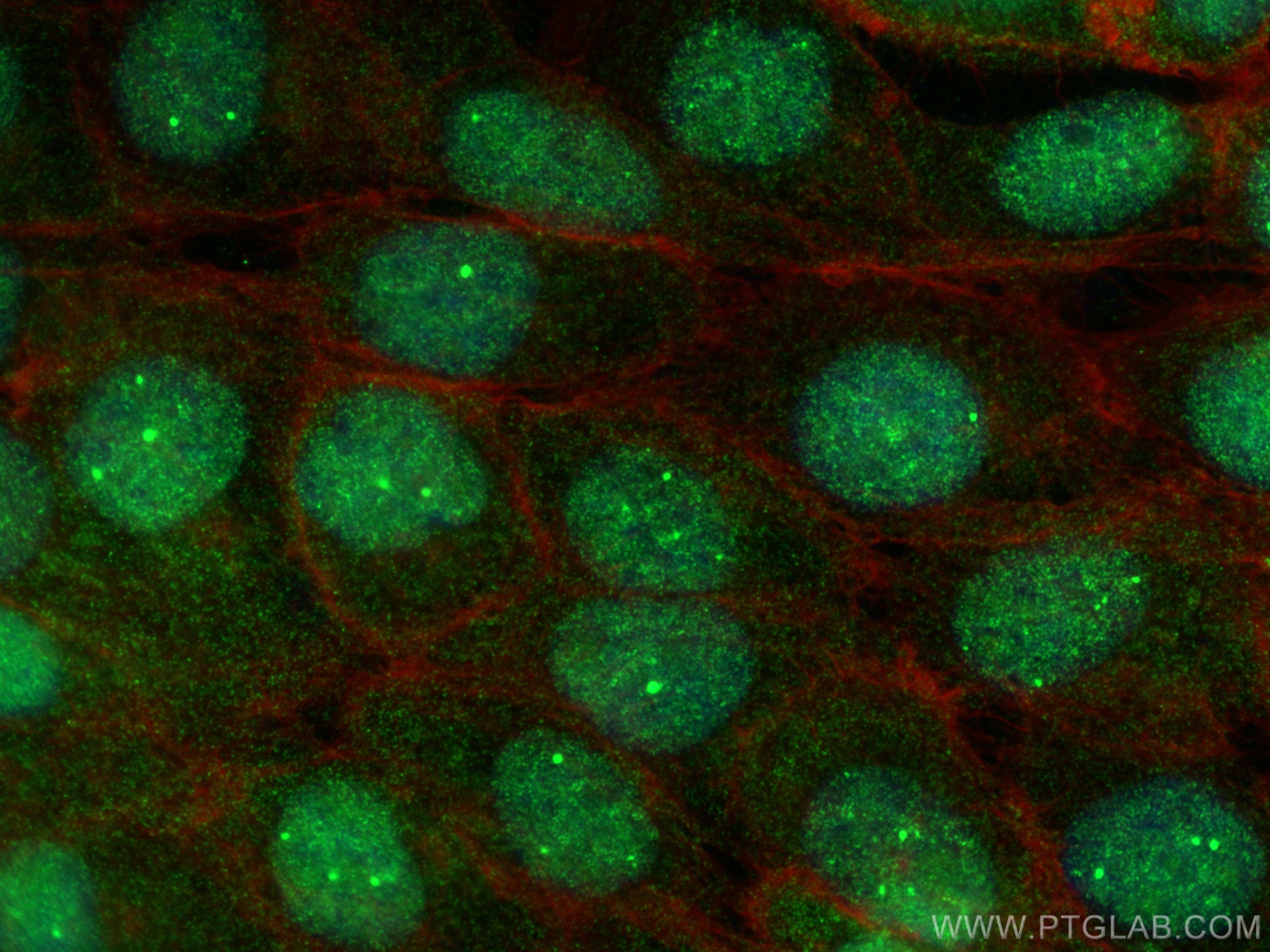 Immunofluorescence (IF) / fluorescent staining of A431 cells using SYNCRIP Polyclonal antibody (30443-1-AP)