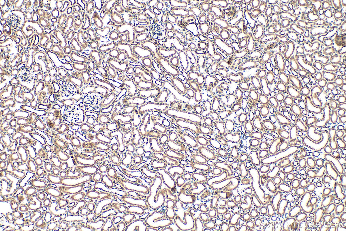 Immunohistochemistry (IHC) staining of mouse kidney tissue using SYNCRIP Polyclonal antibody (30443-1-AP)