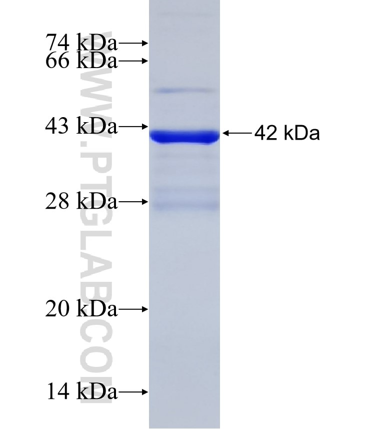 SYNCRIP fusion protein Ag31509 SDS-PAGE