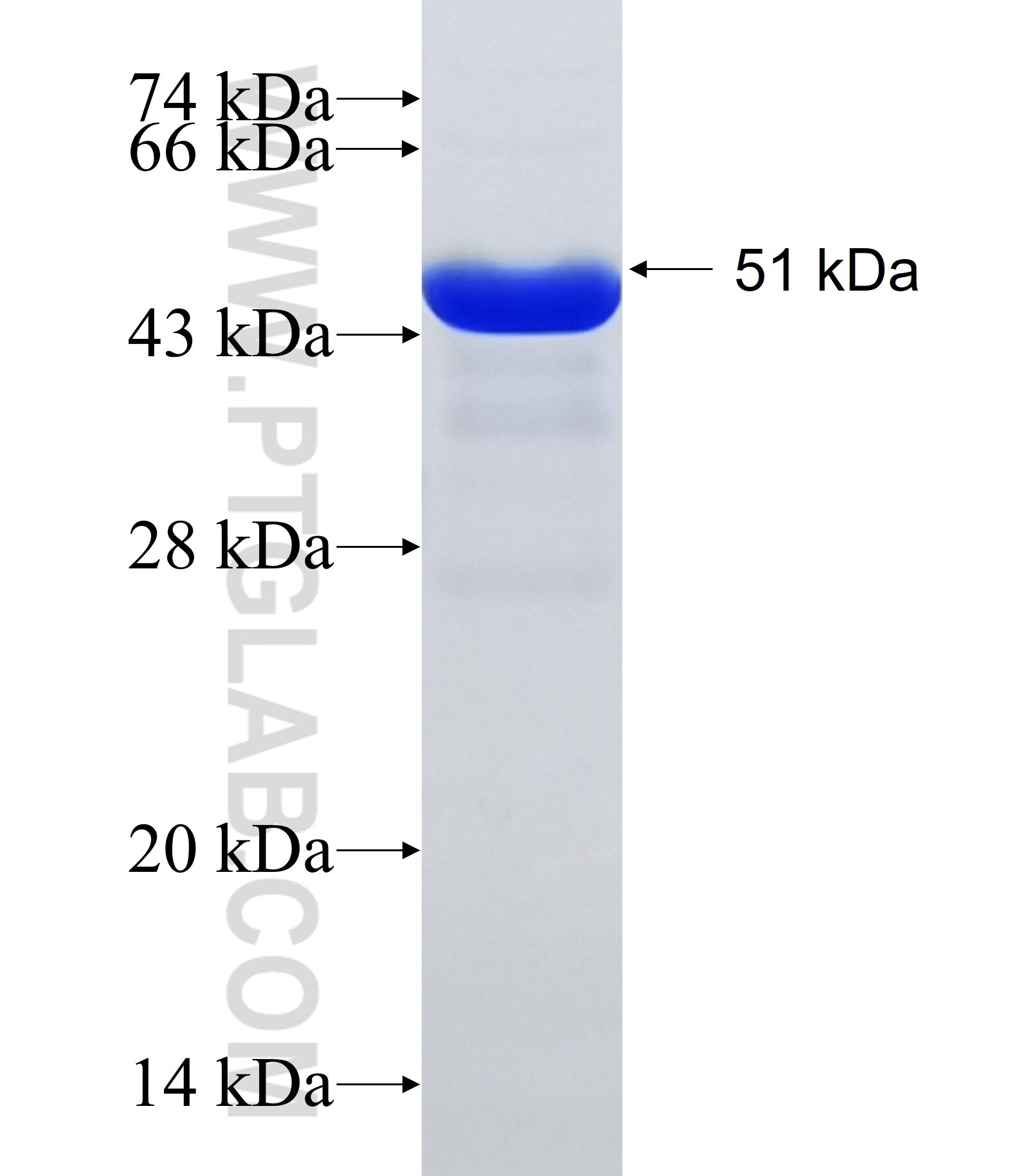 SYNE1 fusion protein Ag34809 SDS-PAGE