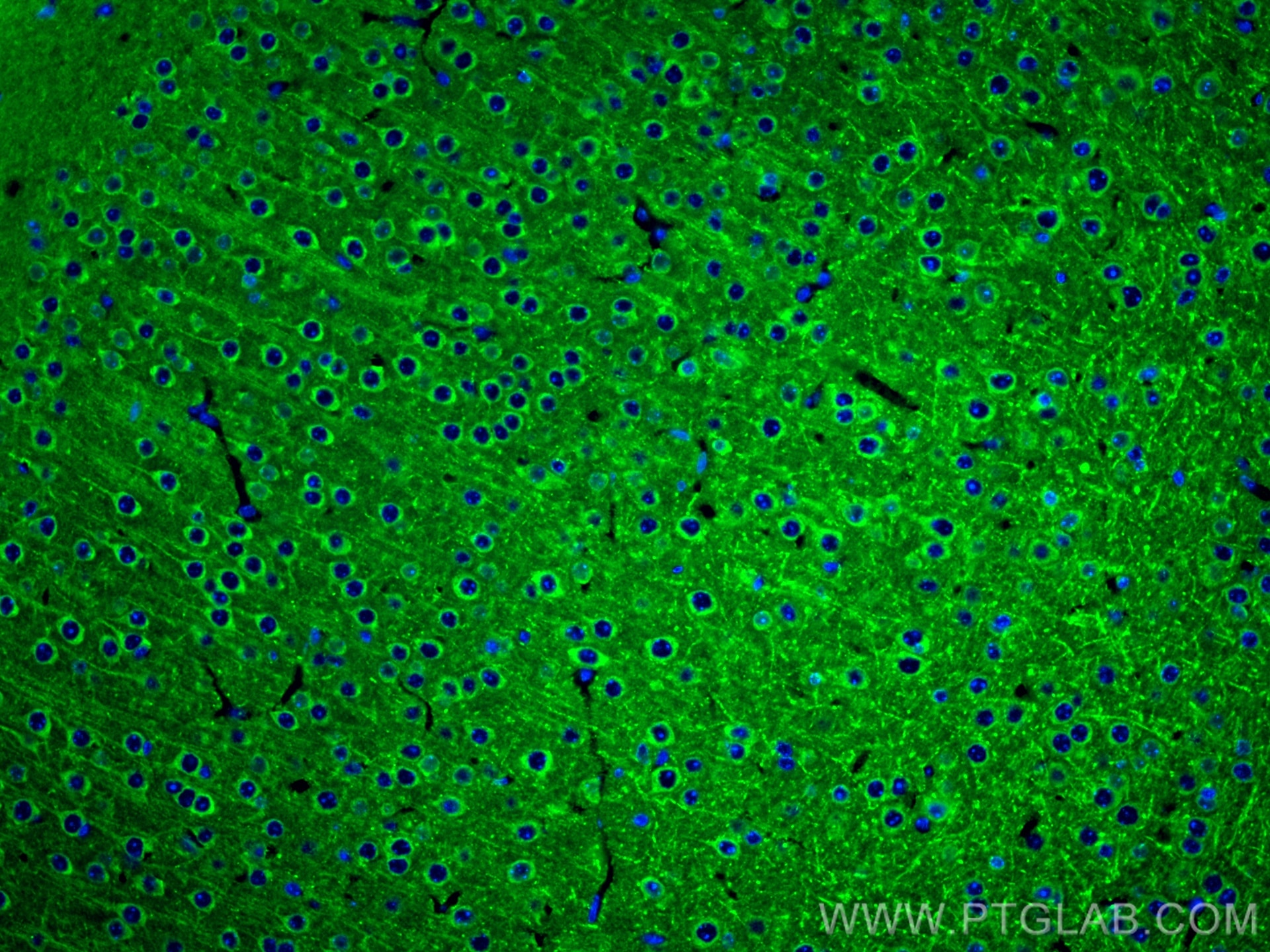 Immunofluorescence (IF) / fluorescent staining of mouse brain tissue using Nesprin 2 Polyclonal antibody (25265-1-AP)