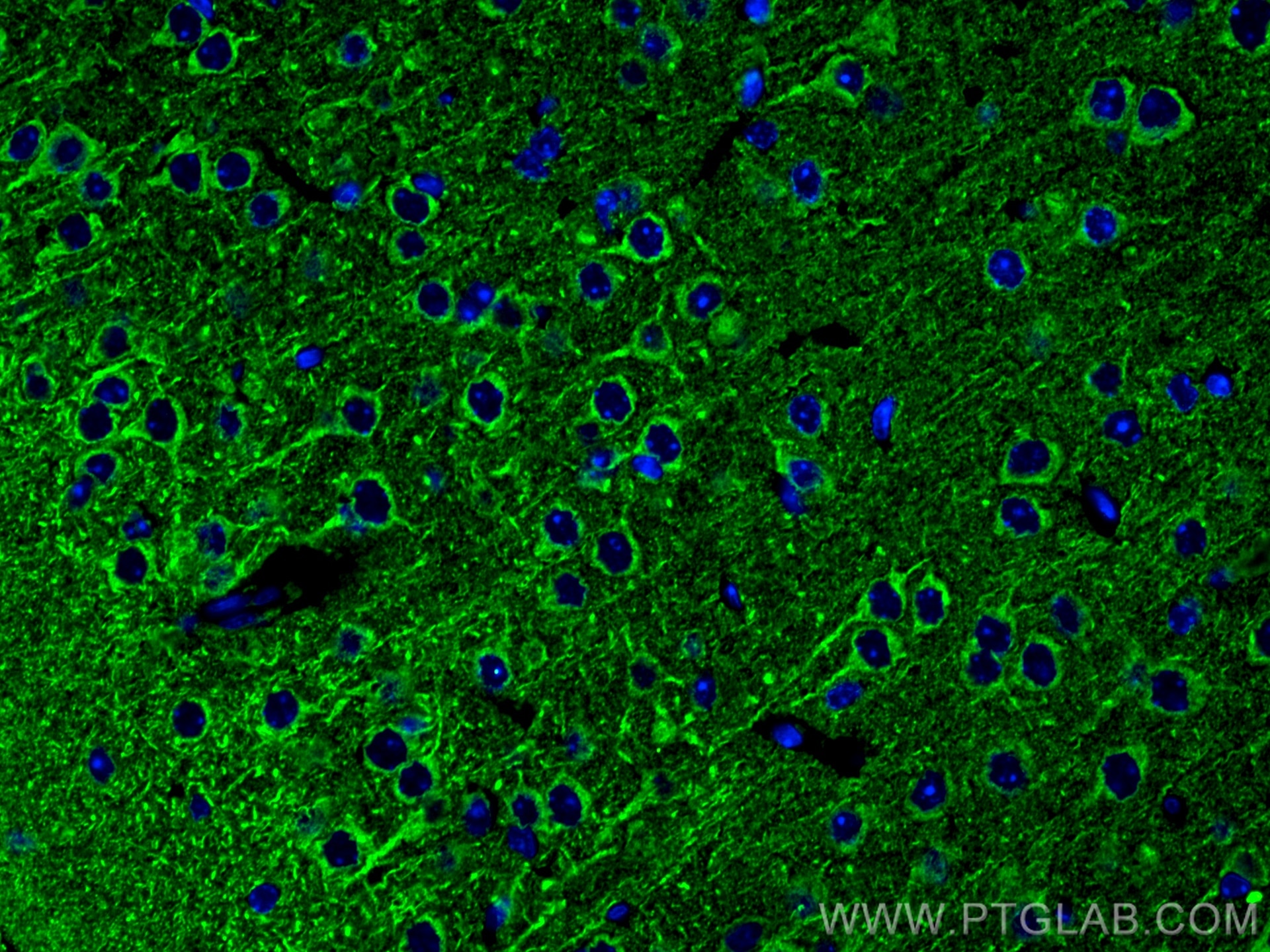 Immunofluorescence (IF) / fluorescent staining of mouse brain tissue using Nesprin 2 Polyclonal antibody (25265-1-AP)